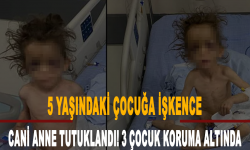 Annesi tarafından işkenceye maruz kalan 5 yaşındaki çocuk yaşam savaşı veriyor