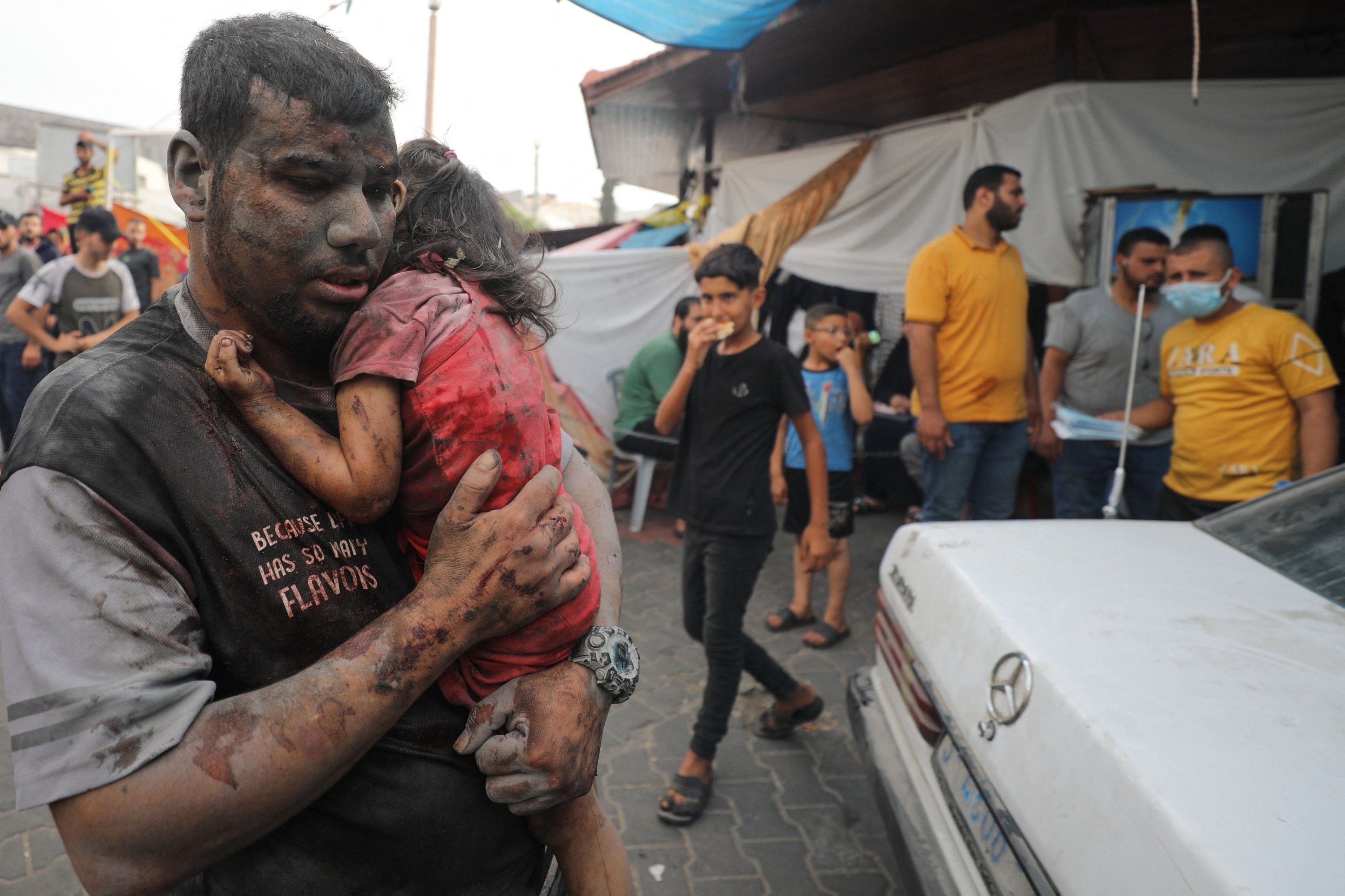 Yaralı bir Filistinli adam ve bir çocuk, İsrail saldırılarının ardından Gazze Şehri'ndeki El Şifa hastanesine varıyor, Gazze Şehri, Filistin, 29 Ekim 2023. (AFP Fotoğrafı)